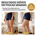 VenusLift Pro | Massageador Anticelulite 4 em 1