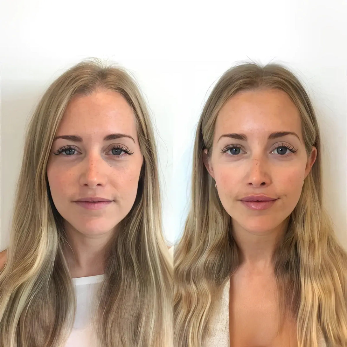LipGlow Pro© | Realce Natural com Volume e Hidratação Imediata